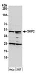 Detection of human SKP2 by western blot.