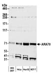 Detection of human ARA70 by western blot.