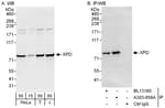 Detection of human XPD by western blot and immunoprecipitation.
