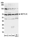 Detection of mouse METTL16 by western blot.