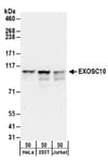 Detection of human EXOSC10 by western blot.
