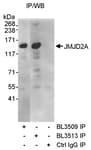 Detection of human JMJD2A by western blot of immunoprecipitates.