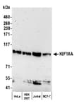 Detection of human KIF18A by western blot.