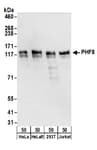 Detection of human PHF8 by western blot.