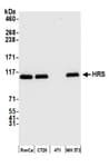 Detection of mouse HRS by western blot.