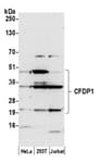 Detection of human CFDP1 by western blot.