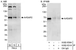 Detection of human ArfGAP2 by western blot and immunoprecipitation.