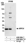 Detection of human ARPC4 by western blot of immunoprecipitates.