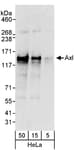 Detection of human Axl by western blot.