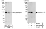 Detection of human DDX26/DICE1 by western blot and immunoprecipitation.