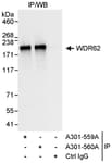 Detection of human WDR62 by western blot of immunoprecipitates.