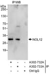 Detection of human NOL12 by western blot of immunoprecipitates.