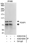 Detection of human FOXP1 by western blot of immunoprecipitates.