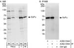 Detection of human and mouse SuFu by western blot (h&amp;m) and immunoprecipitation (h).