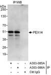Detection of human PEX14 by western blot of immunoprecipitates.