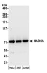Detection of human HADHA by western blot.