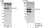 Detection of human EYA2 by western blot and immunoprecipitation.