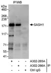 Detection of human SASH1 by western blot of immunoprecipitates.