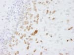 Detection of mouse Coronin 1 by immunohistochemistry.