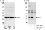 Detection of human RPS2 by western blot and immunoprecipitation.