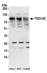 Detection of human TGOLN2 by western blot.
