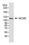 Detection of human MCM6 by western blot.
