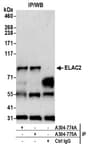 Detection of human ELAC2 by western blot of immunoprecipitates.