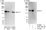 Detection of human and mouse AF17 by western blot (h&amp;m) and immunoprecipitation (h).