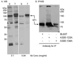 Detection of human SP1 by western blot and immunoprecipitation.