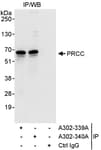 Detection of human PRCC by western blot of immunoprecipitates.