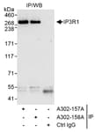 Detection of human IP3R1 by western blot of immunoprecipitates.