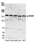 Detection of human INO80 by western blot.