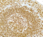 Detection of human HLA/DR/DP/DQ by immunohistochemistry.