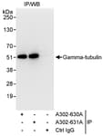 Detection of human Gamma-tubulin by western blot of immunoprecipitates.