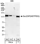 Detection of human Sec23IP(MSTP053) by western blot.