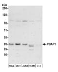 Detection of human PDAP1 by western blot.