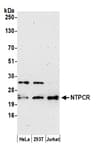 Detection of human NTPCR by western blot.