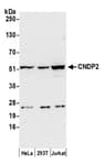 Detection of human CNDP2 by western blot.