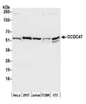 Detection of human and mouse CCDC47 by western blot.