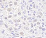 Detection of mouse Rad50 by immunohistochemistry.