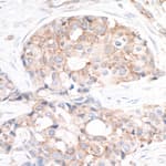 Detection of human RPS6 by immunohistochemistry.