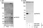 Detection of human PRMT6 by western blot and immunoprecipitation.