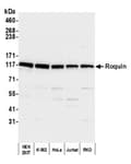 Detection of human Roquin by western blot.