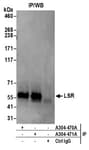 Detection of human LSR by western blot of immunoprecipitates.