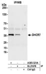 Detection of human DHCR7 by western blot of immunoprecipitates.