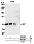 Detection of human NXF1 by western blot of immunoprecipitates.