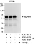 Detection of human HEXIM1 by western blot of immunoprecipitates.