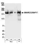 Detection of human and mouse SMARCC2/BAF170 by western blot.