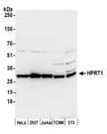 Detection of human and mouse HPRT1 by western blot.