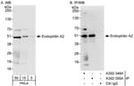 Detection of human Endophilin A2 by western blot and immunoprecipitation.
